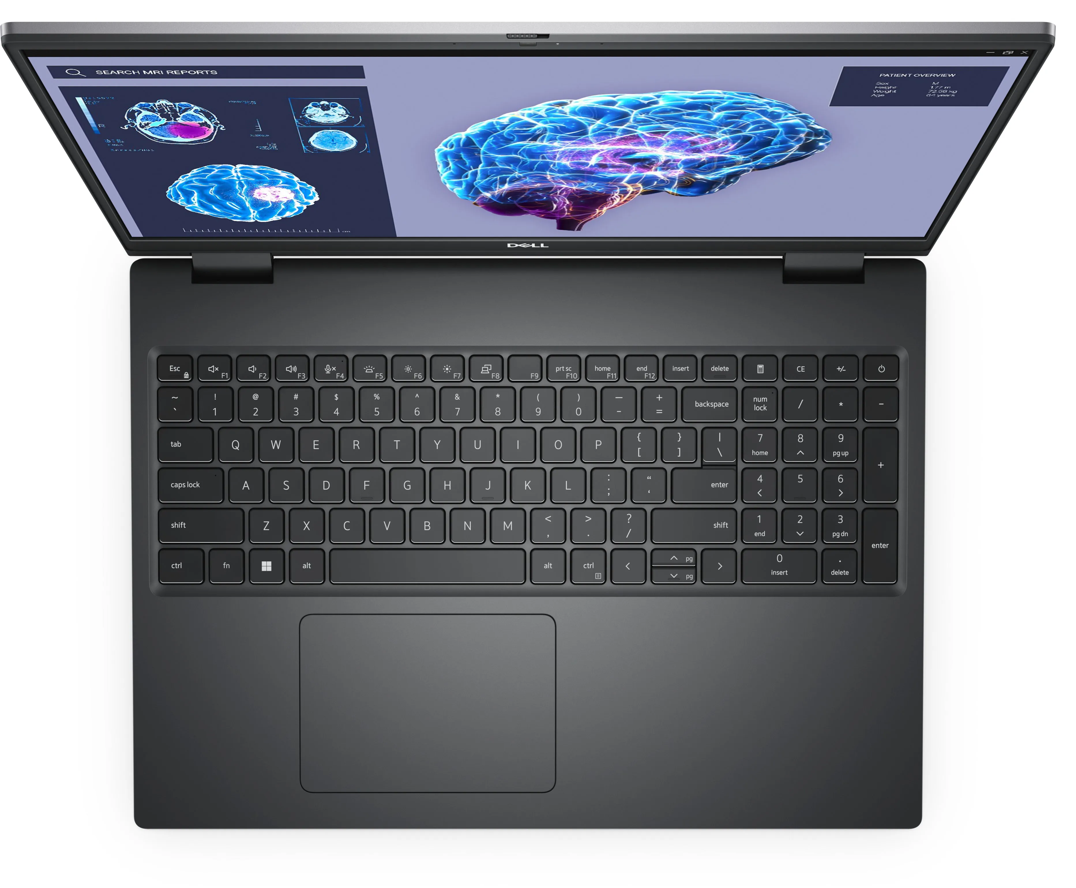 Dell Precision 7680 - Intel Core I9 - 13950Hx / Up To 5.5 Ghz - Win 11 Pro - Nvidia Rtx 3500 Ada - 32 Gb Ram - 1 Tb Ssd